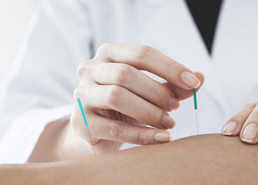 How Does Dry Needling Work