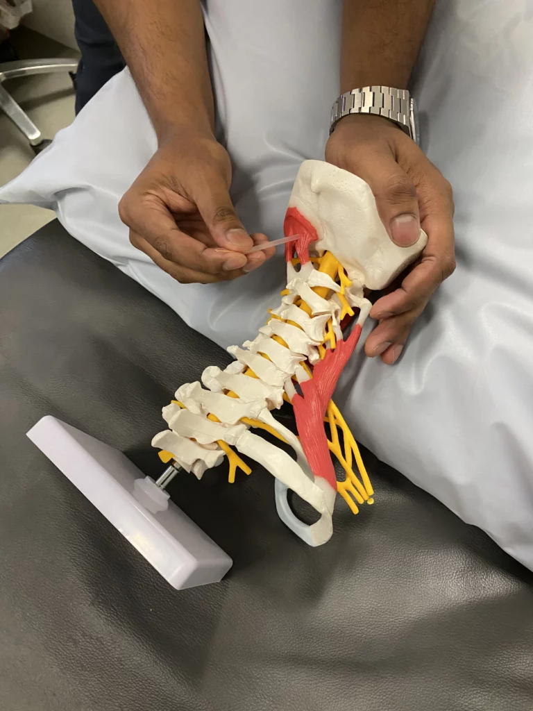 Dry Needling Moonee Ponds
