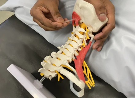 Dry Needling Moonee Ponds