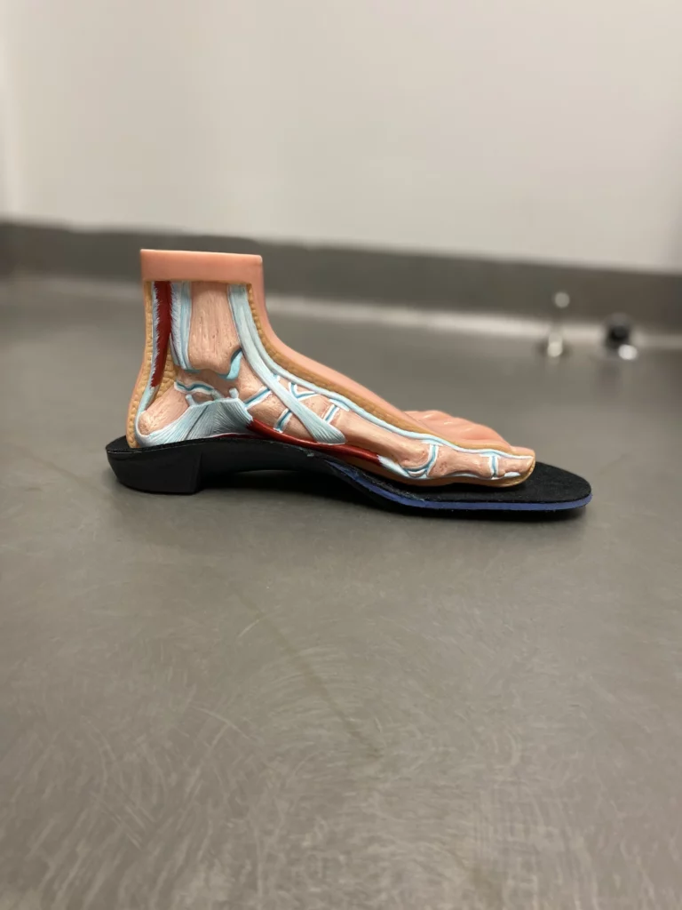 Orthotics for flat feet in Moonee Ponds