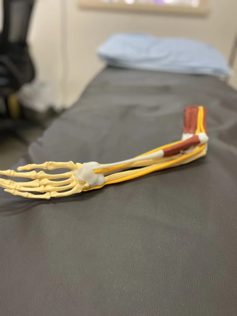 Pinched nerves in a neck