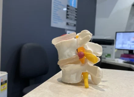 Disc bulges can cause lower back pain