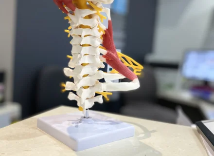 What causes upper trap tightness?