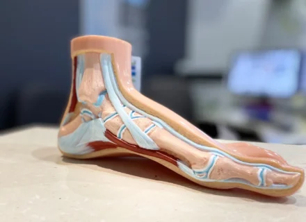Plantar fasciitis can be treated by a podiatrist in a foot clinic