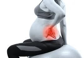 Pregnancy related lower back pain Moonee Ponds