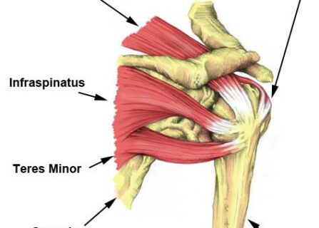 Supraspinatus muscle tear physio brunswick