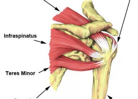 Supraspinatus muscle tear physio brunswick