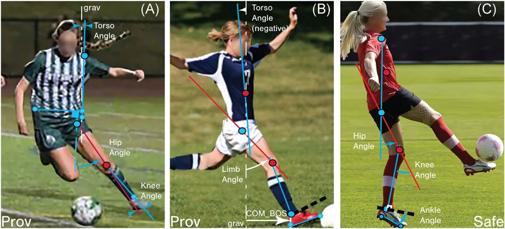 ACL in soccer tear