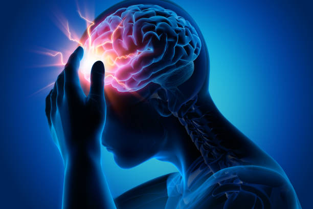 Severe Headache Migraine Medical Illustration 3d Rendering