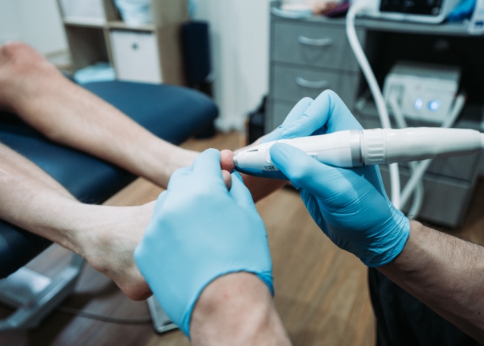 ingrown-toe-nails-nail-surgery-1
