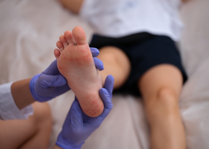 paediatric-podiatry-1
